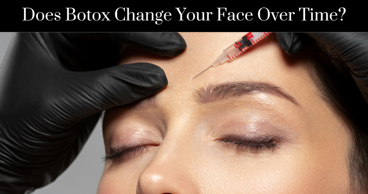 Does Botox Change Your Face Over Time