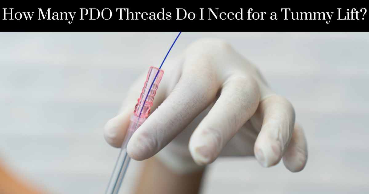 How Many PDO Threads Do I Need for a Tummy Lift - New