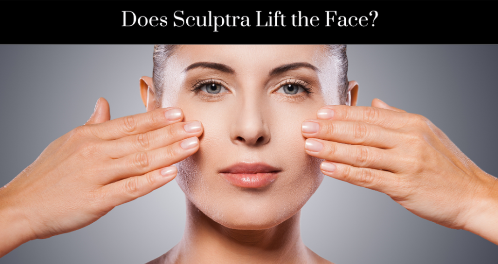 Does Sculptra Lift the Face?