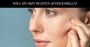Will My Skin Tighten After Kybella - New