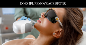 Does IPL Remove Age Spots - New