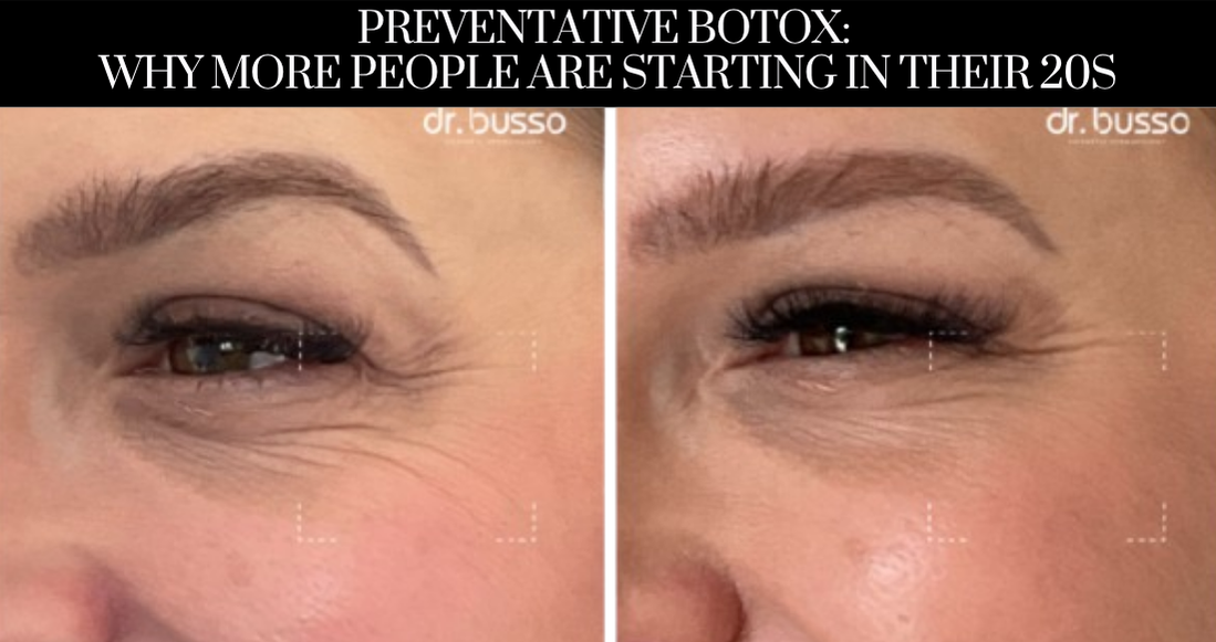 Preventative Botox: Why More People Are Starting in Their 20s