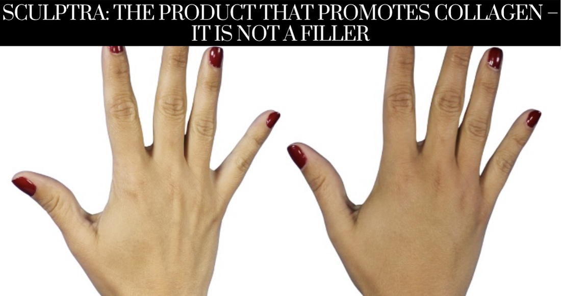 Sculptra: The Product That Promotes Collagen – It Is Not a Filler