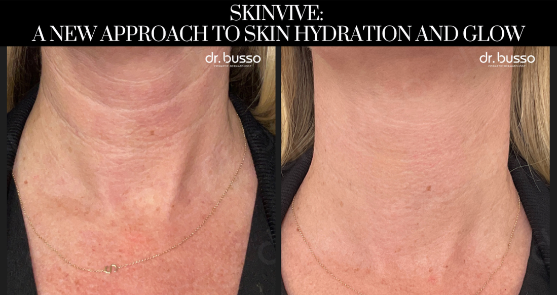 Skinvive A New Approach to Skin Hydration and Glow